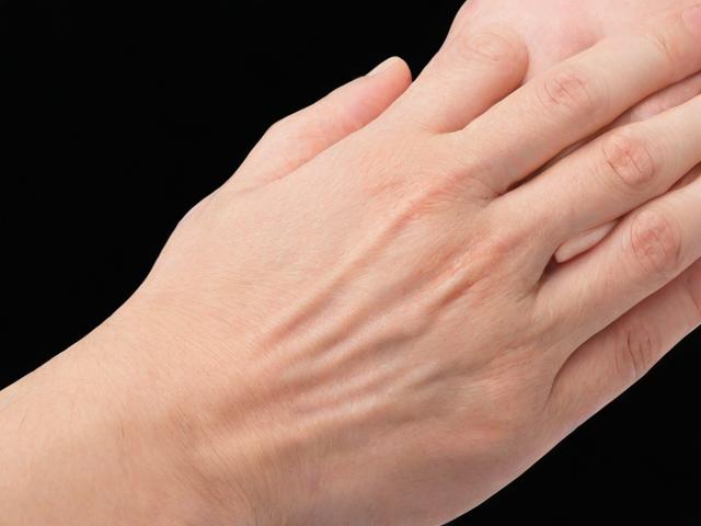 杭州腋秀腋臭专科解析，狐臭手术治疗与术后护理全指南