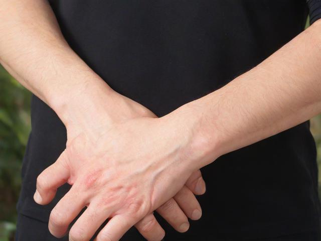 湖州狐臭手术多少钱？详解湖州狐臭手术费用及选择