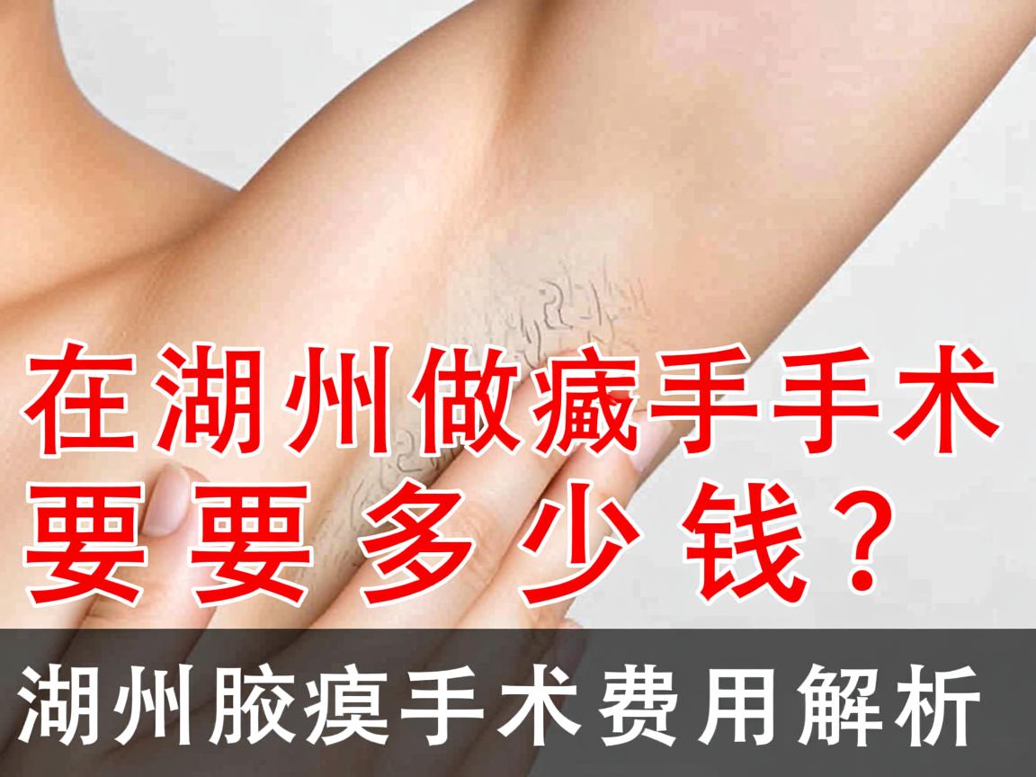 在湖州做腋臭手术要多少钱？湖州腋臭手术费用解析