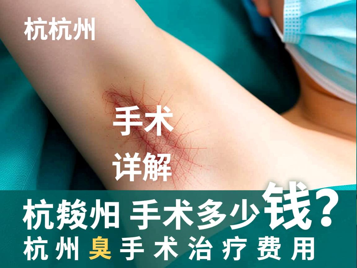 杭州腋臭手术多少钱？详解杭州腋臭手术治疗费用